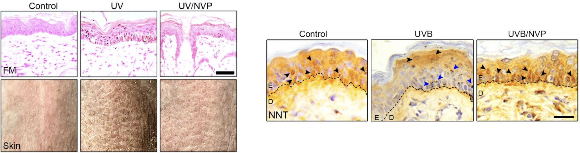 Fontana-Masson histology of UV-exposed skin treated with a PdRN combination